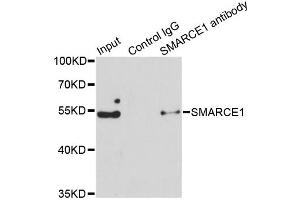 Immunoprecipitation analysis of 150ug extracts of Jurkat cells using 3ug SMARCE1 antibody.