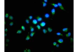 Immunofluorescence staining of Hela cells with ABIN7152772 at 1:96, counter-stained with DAPI. (FGF1 抗体  (AA 16-155))