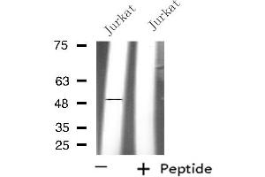 Western blot analysis of extracts from Jurkat cells, using PPM1L antibody. (PPM1L 抗体  (Internal Region))