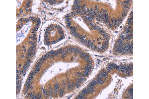 Immunohistochemistry (IHC) image for anti-Spermatogenesis Associated 7 (SPATA7) antibody (ABIN2428779) (SPATA7 抗体)