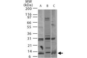 Western blot analysis of Pmaip1 in A) human, B) mouse, and C) rat thymus tissue using Pmaip1 polyclonal antibody  at 2 ug/mL . (NOXA 抗体  (AA 51-66))