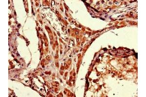 Immunohistochemistry of paraffin-embedded human testis tissue using ABIN7174691 at dilution of 1:100 (ARRDC1-AS1 (AA 1-176) 抗体)