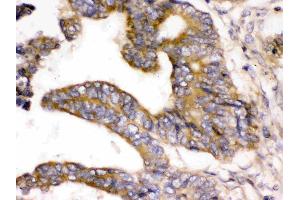 Immunohistochemistry (IHC) image for anti-WNK Lysine Deficient Protein Kinase 1 (WNK1) (AA 1154-1195), (Middle Region) antibody (ABIN4886765)