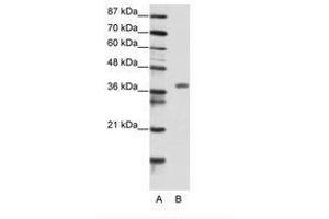 Image no. 1 for anti-Mesenchyme Homeobox 2 (MEOX2) (N-Term) antibody (ABIN202199) (MEOX2 抗体  (N-Term))