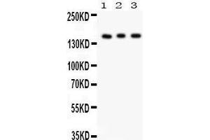 Anti- Insulin Receptor antibody, Western blotting All lanes: Anti Insulin Receptor at 0. (Insulin Receptor 抗体  (C-Term))