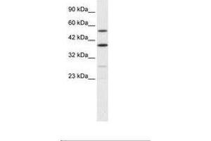 Image no. 2 for anti-A Kinase (PRKA) Anchor Protein 17A (AKAP17A) (AA 48-97) antibody (ABIN6735878) (SFRS17A 抗体  (AA 48-97))