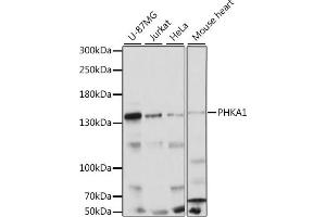 Western blot analysis of extracts of various cell lines, using PHK antibody (5700) at 1:1000 dilution. (PHKA1 抗体  (AA 600-820))