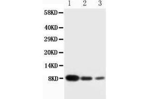 Anti-PF4 antibody, Western blotting Lane 1: Recombinant Human CXCL4 Protein 10ng Lane 2: Recombinant Human CXCL4 Protein 5ng Lane 3: Recombinant Human CXCL4 Protein 2. (PF4 抗体  (C-Term))