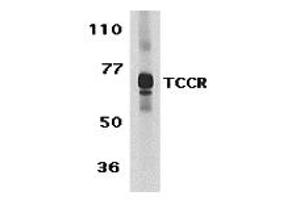 Western Blotting (WB) image for anti-Interleukin 27 Receptor, alpha (IL27RA) (C-Term) antibody (ABIN1030724) (IL27 Receptor alpha 抗体  (C-Term))