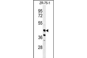 Western blot analysis of FA2H Antibody (Center) (ABIN650994 and ABIN2840028) in ZR-75-1 cell line lysates (35 μg/lane). (FA2H 抗体  (AA 121-148))