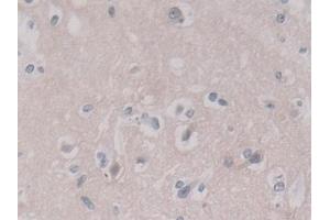 Detection of ANXA11 in Human Cerebrum Tissue using Polyclonal Antibody to Annexin A11 (ANXA11) (Annexin A11 抗体  (AA 1-505))