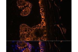 Immunofluorescence (IF) image for anti-Keratin 14 (KRT14) antibody (ABIN7258338)