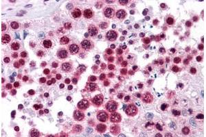Human Testis: Formalin-Fixed, Paraffin-Embedded (FFPE) (HMGB2 抗体  (AA 1-196))
