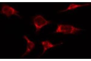 ABIN6276366 staining HepG2 by IF/ICC. (IL-2 抗体  (Internal Region))