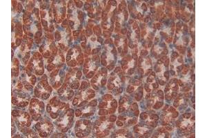 Immunohistochemistry (IHC) image for anti-Hexokinase 1 (HK1) (AA 413-540) antibody (ABIN7437755)