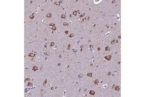 Immunohistochemical staining of human cerebral cortex with FAM173A polyclonal antibody  shows strong cytoplasmic positivity in neuronal cells. (FAM173A 抗体)