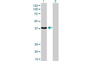 Western Blot analysis of EPM2A expression in transfected 293T cell line by EPM2A monoclonal antibody (M02), clone 6C6. (EPM2A 抗体  (AA 101-199))