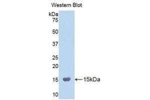 Western Blotting (WB) image for anti-Lysyl Oxidase-Like 2 (LOXL2) (AA 323-427) antibody (ABIN1859684) (LOXL2 抗体  (AA 323-427))