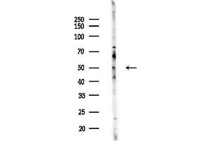 Western blot analysis of lysates from HepG2 cells(heat-shock,45 min treatment), using MYLIP Antibody at 1/1000 dilution.