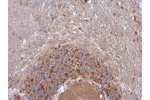 IHC-P Image NDUFB5 antibody detects NDUFB5 protein at cytoplasm in rat brian by immunohistochemical analysis. (NDUFB5 抗体  (C-Term))