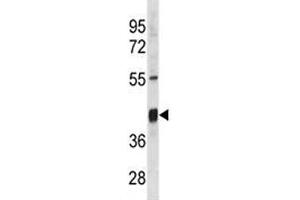 Txnip antibody western blot analysis in mouse stomach tissue lysate. (TXNIP 抗体  (AA 116-145))