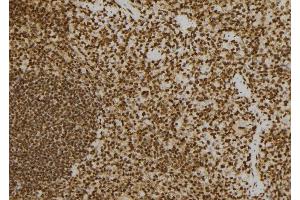 ABIN6277577 at 1/100 staining Mouse spleen tissue by IHC-P. (PRKRA 抗体  (Internal Region))