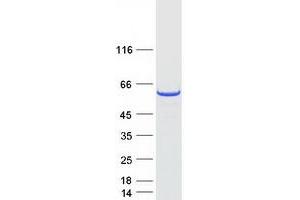 Western Blotting (WB) image for Myosin Binding Protein H (MYBPH) protein (Myc-DYKDDDDK Tag) (ABIN2726627)