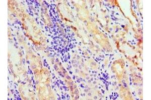 Immunohistochemistry (IHC) image for anti-Annexin A11 (ANXA11) (AA 276-505) antibody (ABIN7144263)