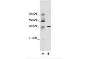 Image no. 1 for anti-Zinc Finger Protein 124 (ZNF124) (N-Term) antibody (ABIN202167) (ZNF124 抗体  (N-Term))