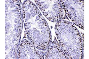 IHC analysis of MED8 using anti-MED8 antibody . (MED8 抗体  (AA 1-195))