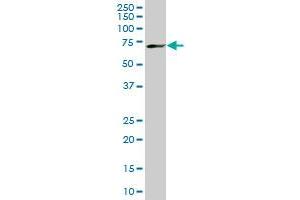 MBD1 monoclonal antibody (M02), clone 2C7. (MBD1 抗体  (AA 415-508))