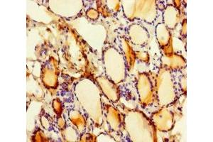 Immunohistochemistry of paraffin-embedded human thyroid tissue using ABIN7169807 at dilution of 1:100 (SLITRK6 抗体  (AA 621-821))