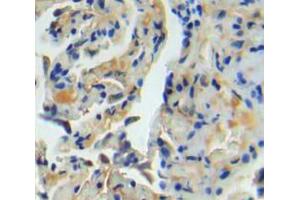 Used in DAB staining on fromalin fixed paraffin-embedded lung tissue (TNC 抗体  (AA 174-621))