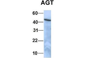 Host:  Rabbit  Target Name:  EGFL8  Sample Type:  HepG2  Antibody Dilution:  1. (AGT 抗体  (N-Term))