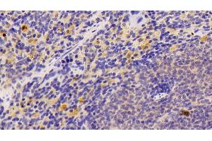 Immunohistochemistry (IHC) image for anti-Nuclear Factor kappa B (NFkB) (AA 42-367) antibody (ABIN7434137)