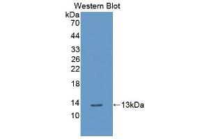 Western blot analysis of the recombinant protein. (PLXNB1 抗体  (AA 581-727))