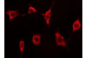 ABIN6273510 staining A549 cells by IF/ICC. (EIF4G2 抗体  (N-Term))