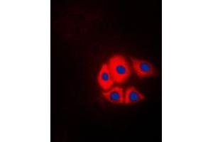 Immunofluorescent analysis of p130 Cas (pY249) staining in NIH3T3 cells. (BCAR1 抗体  (pTyr249))
