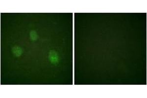 Immunofluorescence analysis of HeLa cells, using AurB (Ab-12) Antibody. (Aurora Kinase B 抗体  (AA 1-50))