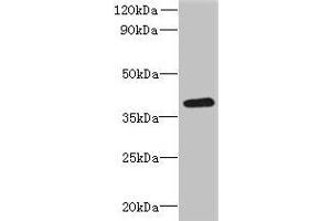 Western blot All lanes: RSPH14 antibody at 8 μg/mL + 293T whole cell lysate Secondary Goat polyclonal to rabbit IgG at 1/10000 dilution Predicted band size: 39 kDa Observed band size: 39 kDa (RTDR1 抗体  (AA 1-230))