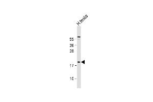 Anti-CT45A3 Antibody (Center) at 1:1000 dilution + human testis lysate Lysates/proteins at 20 μg per lane.