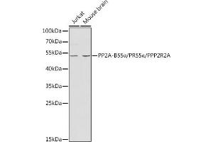 Western blot analysis of extracts of various cell lines, using PP2A-B55α/PR55α/PPP2R2A antibody (ABIN3023153, ABIN3023154, ABIN3023155 and ABIN6219415) at 1:1000 dilution.