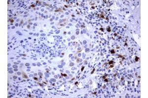 Image no. 5 for anti-Thymidylate Synthetase (TYMS) antibody (ABIN1501595)