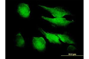Immunofluorescence of purified MaxPab antibody to FGF1 on HeLa cell. (FGF1 抗体  (AA 1-155))