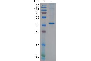 Chitinase 3-Like 1 (Cartilage Glycoprotein-39) (CHI3L1) (AA 22-383) protein (His tag)