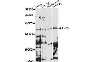 Western blot analysis of extracts of various cell lines, using CDK12 antibody (ABIN6291897) at 1:1000 dilution. (CDK12 抗体)