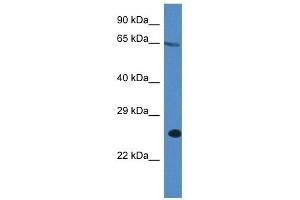 Western Blot showing ITPRIP antibody used at a concentration of 1 ug/ml against A549 Cell Lysate (ITPRIP 抗体  (C-Term))