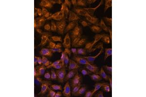 Immunofluorescence analysis of U-2 OS cells using 43713 antibody (ABIN6128759, ABIN6147556, ABIN6147557 and ABIN6216776) at dilution of 1:100. (Septin 5 抗体  (AA 1-369))