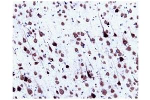 Immunohistochemistry (IHC) image for anti-Small Nuclear Ribonucleoprotein Polypeptide N (SNRPN) (AA 14-174) antibody (ABIN968086) (SNRPN 抗体  (AA 14-174))