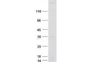 Western Blotting (WB) image for tau Tubulin Kinase 1 (Ttbk1) protein (Myc-DYKDDDDK Tag) (ABIN2734467)